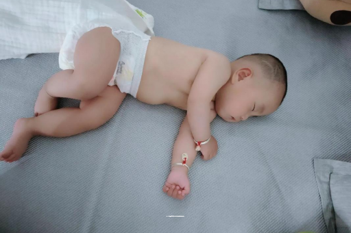 兰考六个月宝宝眼睛散光